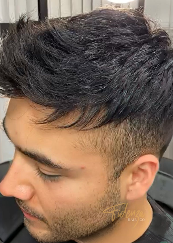mens non-surgical hair replacement la jolla ca - fidenza hair co