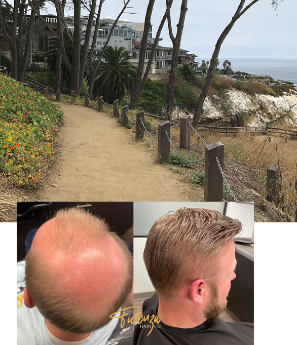 custom mens hair replacement la jolla La Jolla CA Fidenza Hair Co.