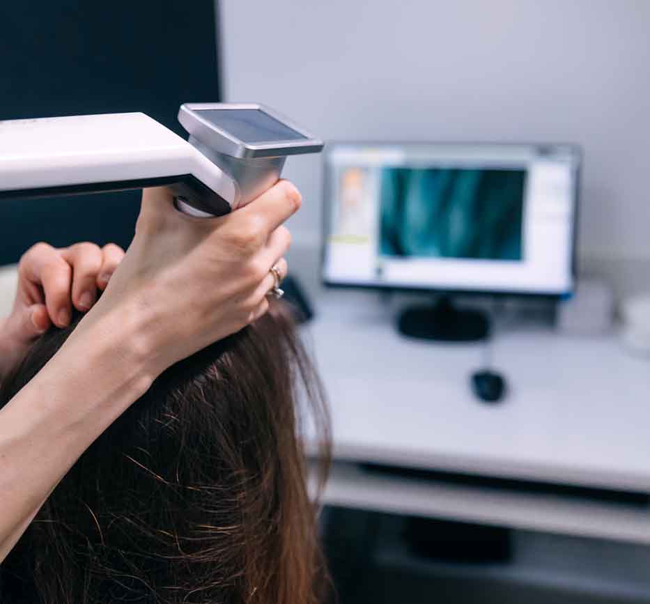 understanding hair loss faq fidenza san diego ca