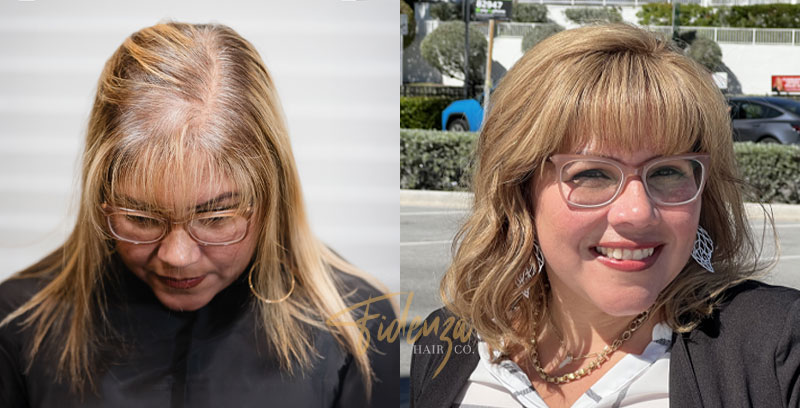 womens non-surgical hair replacement la jolla california - fidenza hair co
